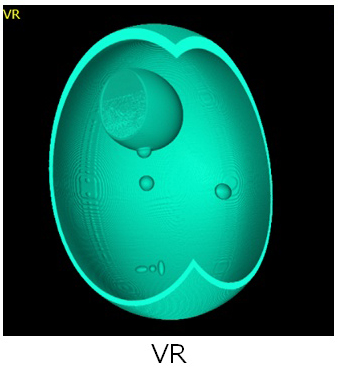 Volume Rending Ct ct_rendering_Volume-Rendering_render1 | Technical Detail | TomoShop ...